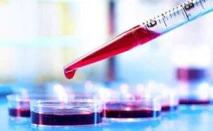 Test colesterolo: non più a digiuno