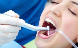 Denti: una spia sulla salute del tuo cuore