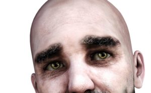 Il rischio di malattie cardiache aumenta di cinque volte per gli uomini calvi e ingrigiti